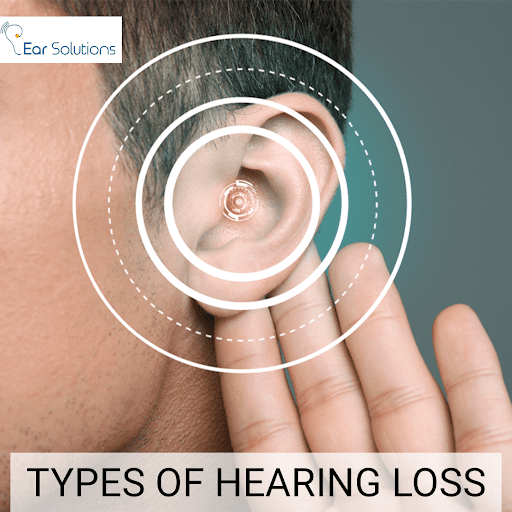 types of hearing loss