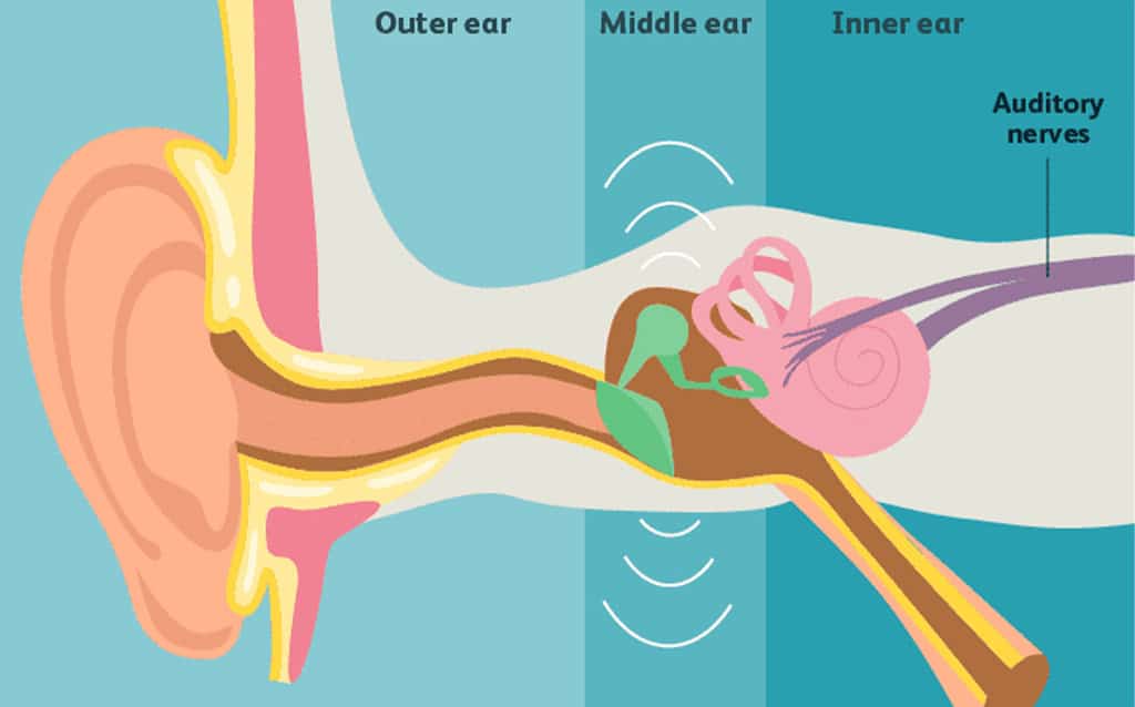 Objective Tinnitus