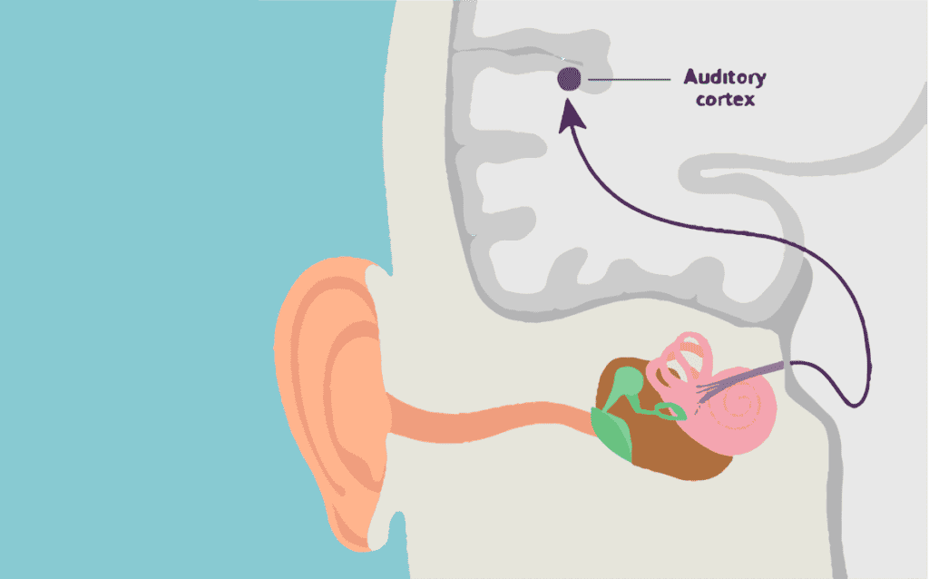 Subjective Tinnitus