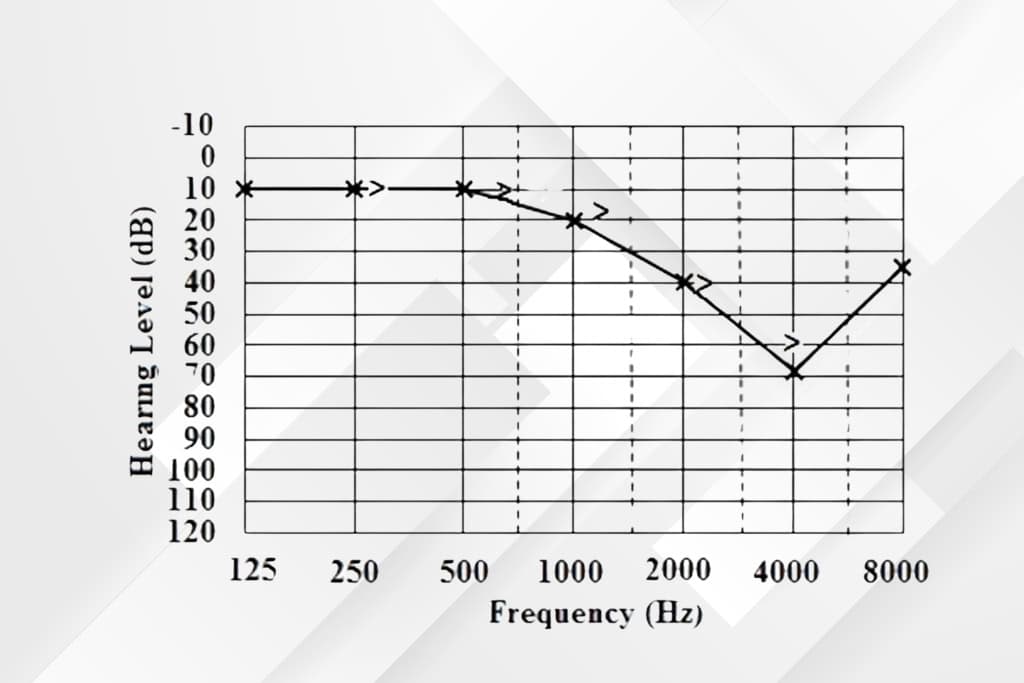 Audiogrmmm 1