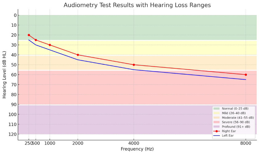 Audiometry Test Results
